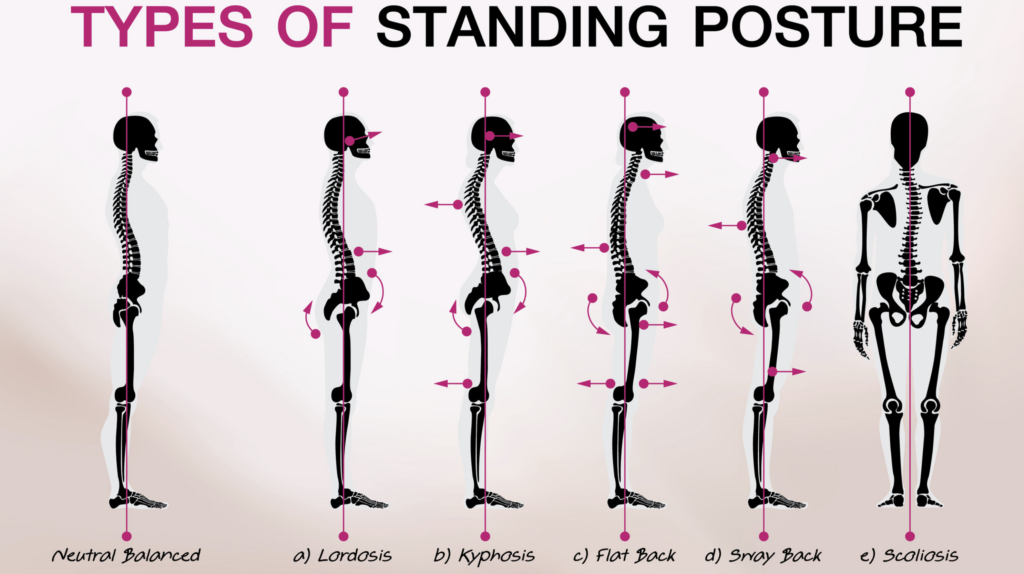 yoga for posture correction